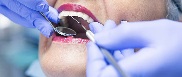 Best Broken or Cracked Tooth Emergency Dentist in Newmanstown, PA